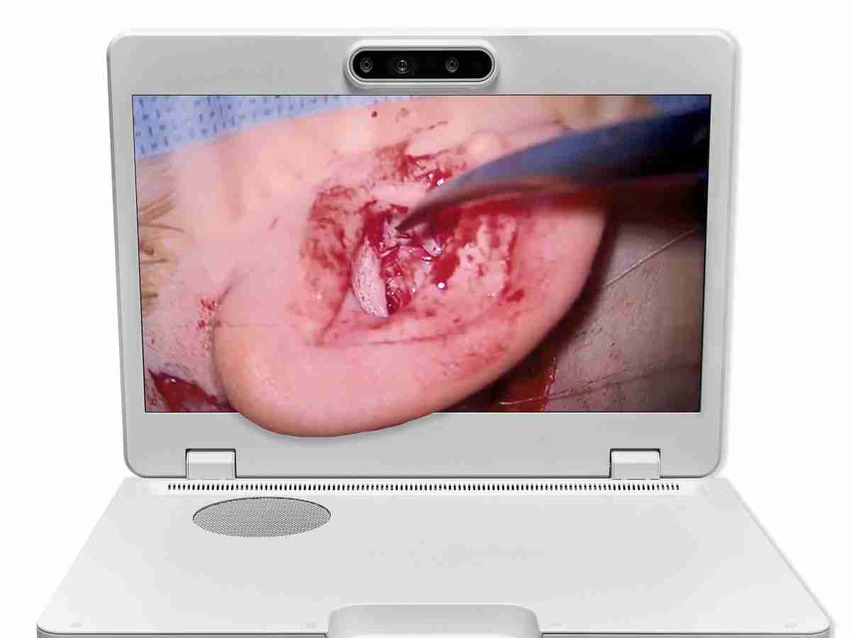 达擎之＂Heads-up 3D显微手术显示系统＂，，整合4K裸眼3D显示及眼球追踪系统，，，，具备快速追踪人眼移动位置功能，，，减轻医师长时间维持固定姿势的负担，，让医师能有更宽广清晰的3D立体视野及更舒适的姿势来执行手术。。。